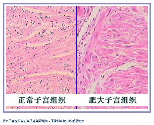 有多少种借精试管婴儿方案？