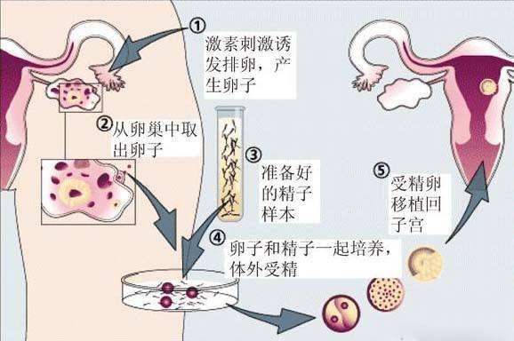 借卵生子代生试管的母亲吕秀莲谈生孩子的问题