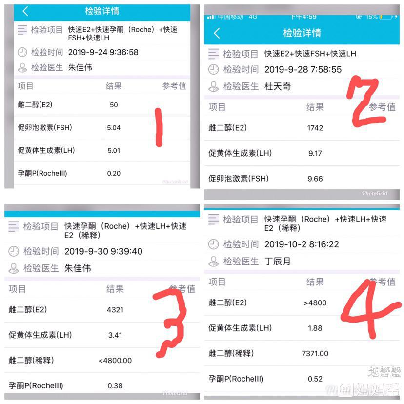梦见自己做供卵试管婴儿是双胞胎