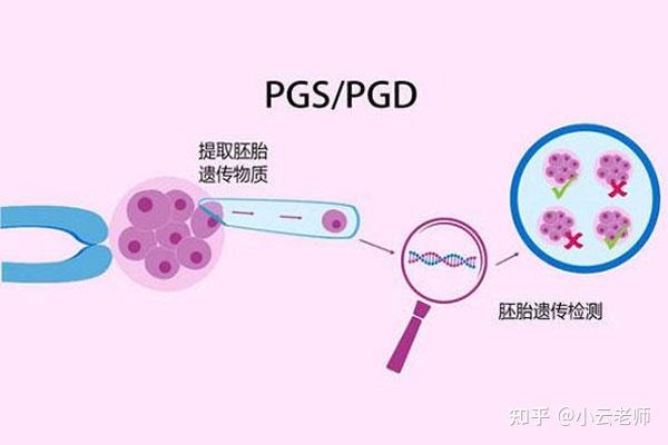 如何有效预防出生缺陷,三代代怀妈妈应聘为你把关!