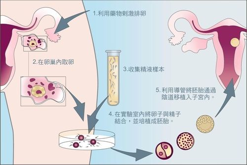 国妇婴精子库+国妇婴黄荷凤