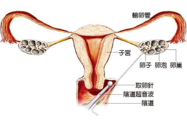 卵泡期雌二醇正常值